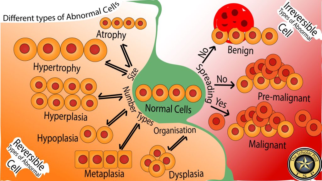 This figure shows different types of abnormal cells and their associated diseases.