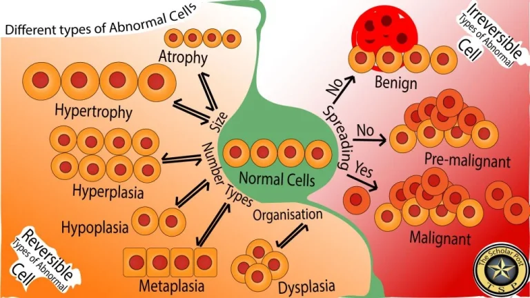 Illustration showing different types of abnormal cells including atrophy, hypertrophy, hyperplasia, metaplasia, dysplasia, and progression from benign to malignant tumors.